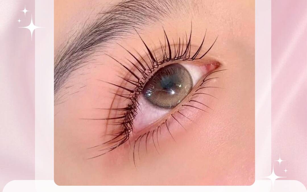 nôi mi mắt sụp