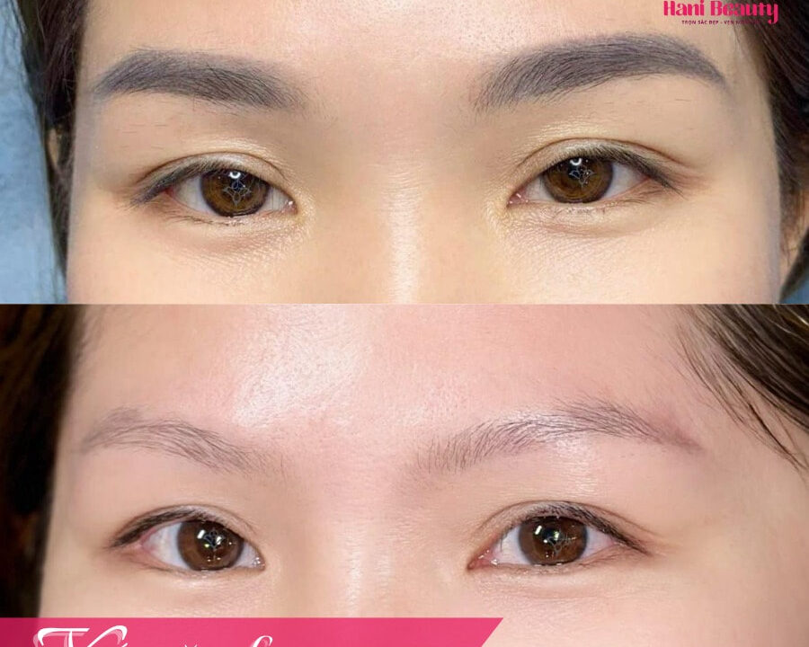 Chân mày trổ xanh