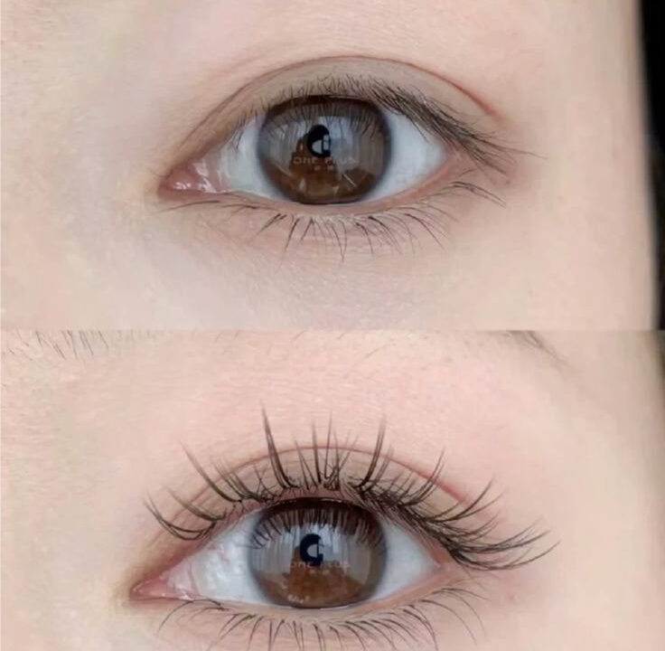 Nối mi đơn giản