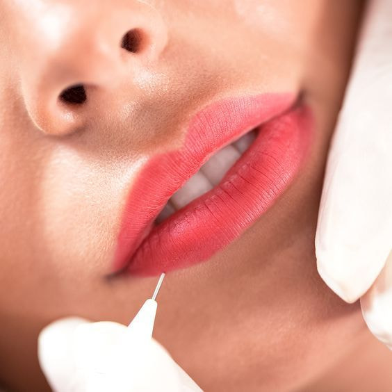 Phun Môi Không Tê: Ưu Điểm Vượt Trội Và Hạn Chế Cần Lưu Ý 15 phun moi khong te Ms Hani 5
