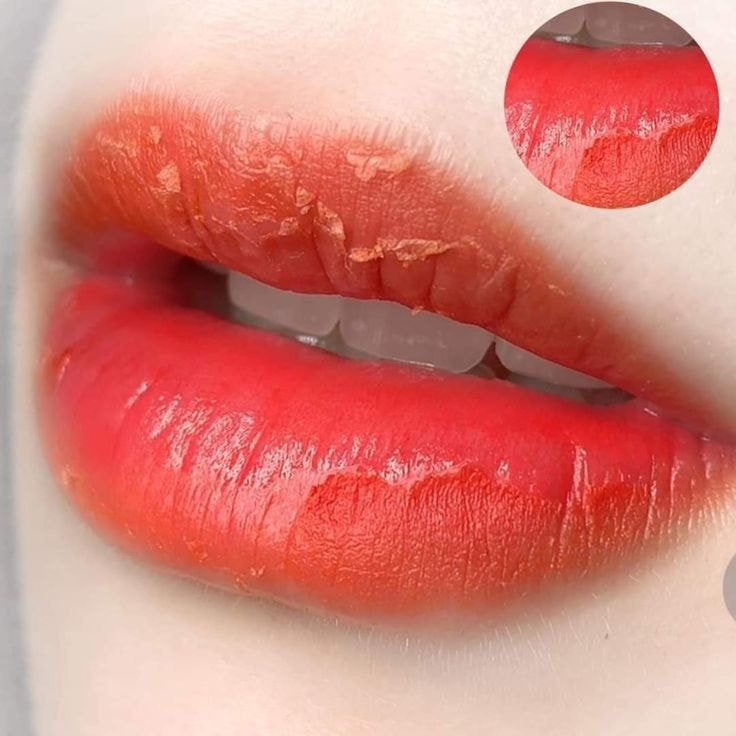Phun Môi Dặm Lại Có Đau Không? Nguyên Nhân Và Giải Pháp 20 Phun moi dam lai co dau khong Ms Hani 6