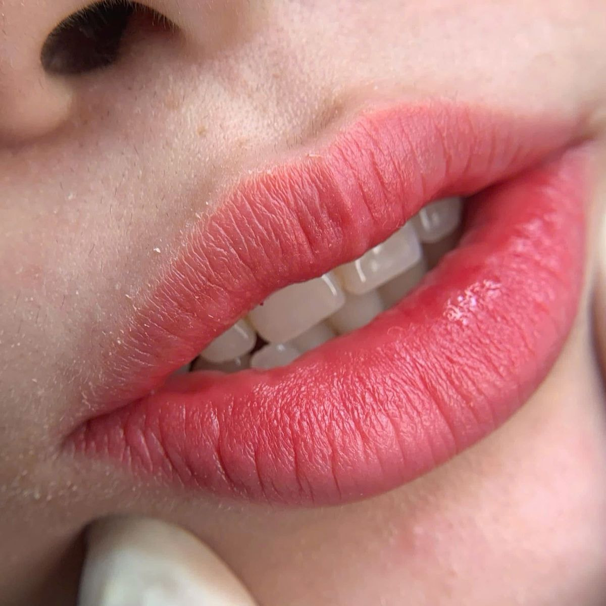 Phun Môi Xong Có Được Uống Bia Không? Hướng Dẫn Chăm Sóc Đúng Cách 14 Phun moi xong co duoc uong bia khong Ms Hani 3