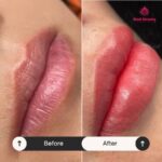 Dịch vụ phun môi collagen giá rẻ tại Hani Beauty – Lựa chọn số 1 cho phái đẹp