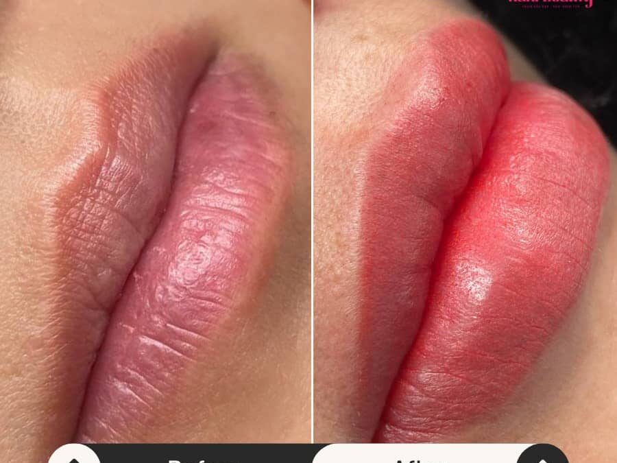 Dịch vụ phun môi collagen giá rẻ tại Hani Beauty – Lựa chọn số 1 cho phái đẹp 20 Dịch vụ phun môi collagen giá rẻ tại Hani Beauty – Lựa chọn số 1 cho phái đẹp