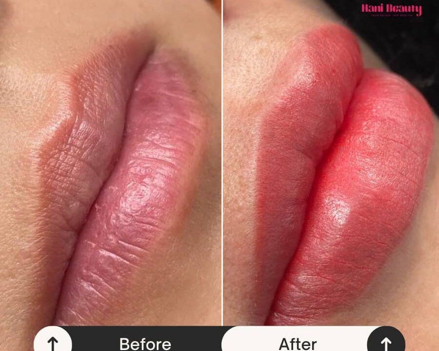 Dịch vụ phun môi collagen giá rẻ tại Hani Beauty – Lựa chọn số 1 cho phái đẹp